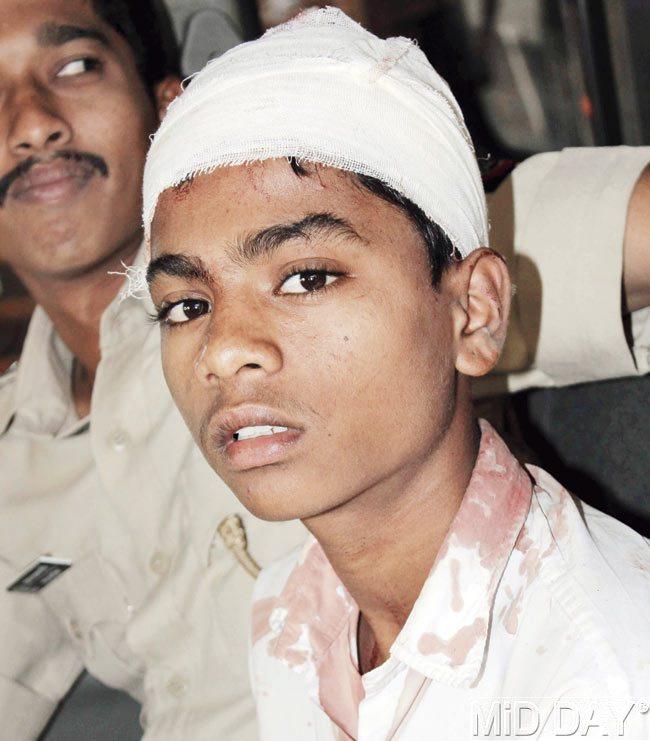 Anoop Patekar sustained injuries on his head, when he was beaten up by three unidentified persons in Thane. Pic/Sameer Markande