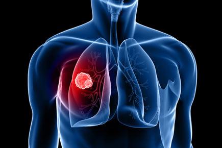 New breathalyser test to detect lung cancer