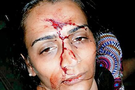 Pune Crime: Robbers smash car window, assault bizman's family