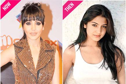 B-Town's plastic surgeries and their disastrous results