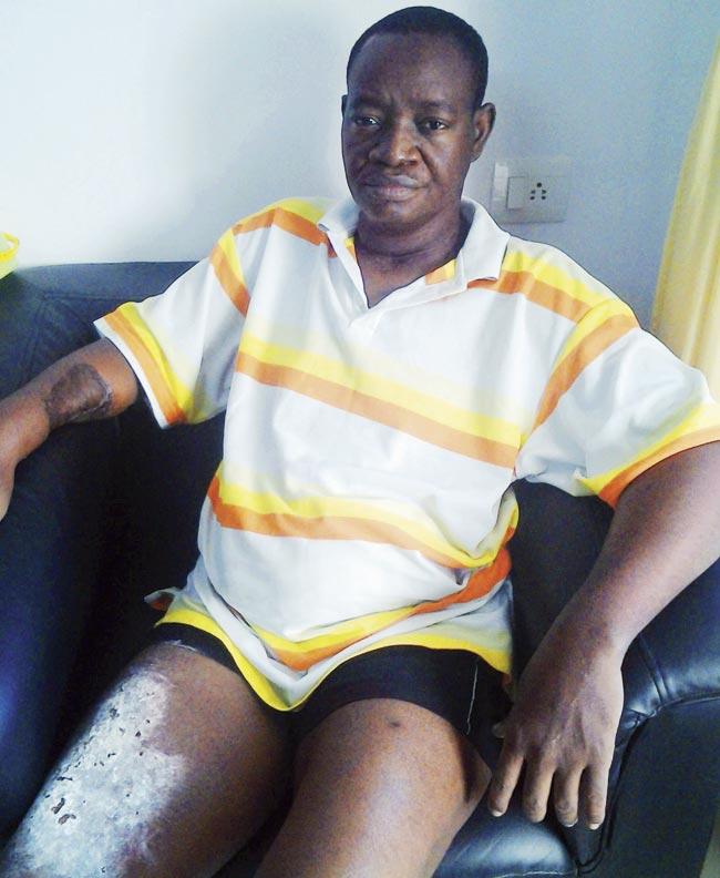 Nuruddin Shittu (45) decided to come to Fortis Healthcare for treatment after doctors in Nigeria informed him that his food pipe could not be salvaged
