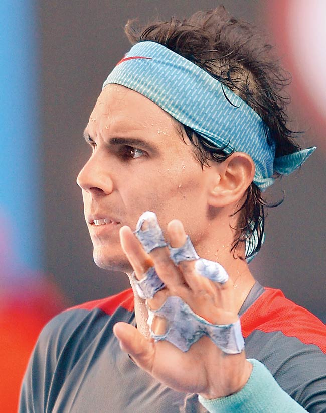 Rafael Nadal’s bandaged hand. Pic/AFP 