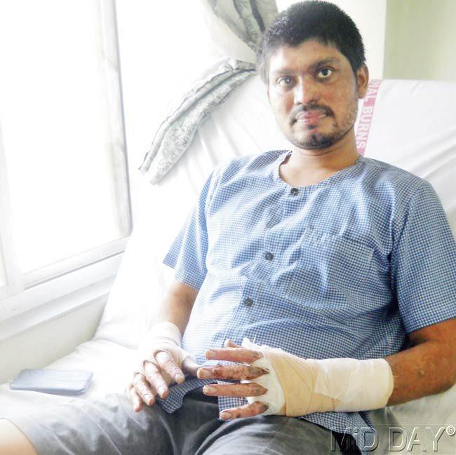 Sunil Naik, with 27 per cent burns, had the maximum injuries and is still recovering at National Burns Centre, Airoli