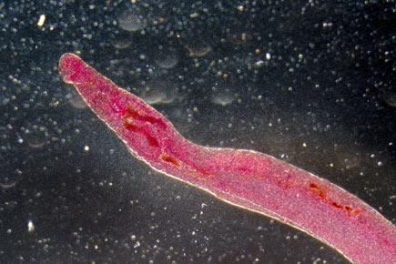 Cancer-causing worm heals wounds: Study