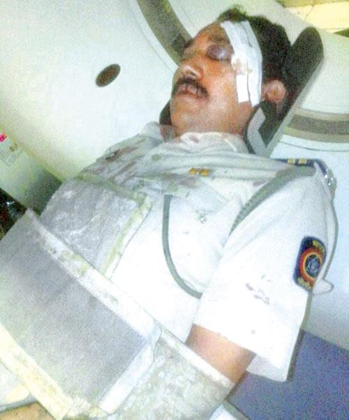 Constable Kailash Baste suffered a fractured skull and was taken to Fortis Hospital in Mulund