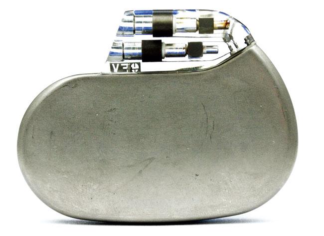 The leadless pacemaker is placed directly inside the patient’s heart without surgery. Pic for representational purpose