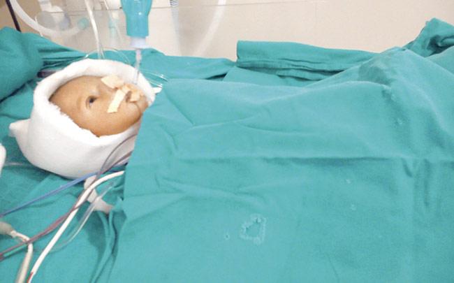 The child is in the neo-natal intensive care unit of Dr D Y Patil Hospital