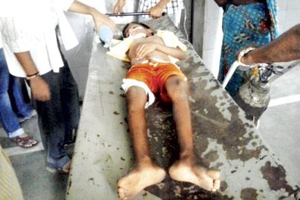 Snakebite lands 9-yr-old Thane boy in ICU