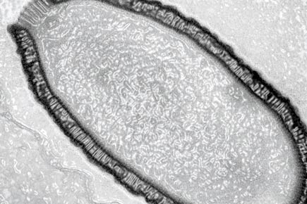Scientists revive 'biggest ever' virus locked in Siberian ice for 30,000 years