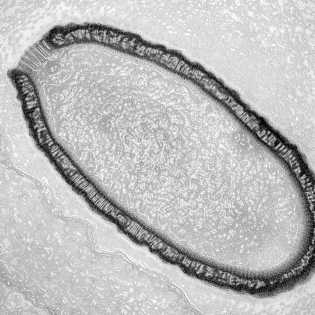 A closeup of the 30,000-year old virus infecting an amoeba cell. Scientists say the virus is a type they have never seen before and warn that global warming could lead to more being uncovered