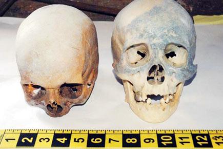 Halloween skulls turn out to be human remains