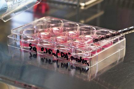 World's first lab-grown stem cells implanted
