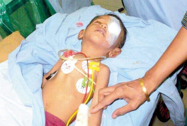 Suffering since birth: Ayush has undergone a surgery for cataract in  one eye and is scheduled for a second surgery  in two weeks or so
