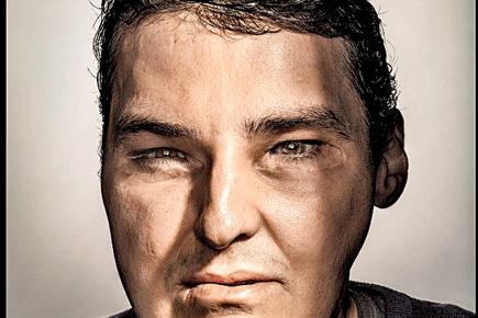 Man with face transplant is GQ cover star this month
