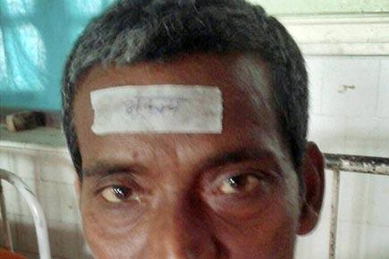 Bihar hospital pastes 'bhukamp' sticker on the forehead of injured; probe ordered