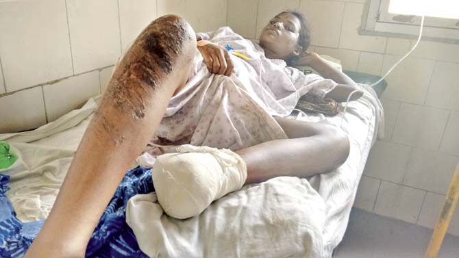 Jamna Pawar recuperating at the Sion Hospital