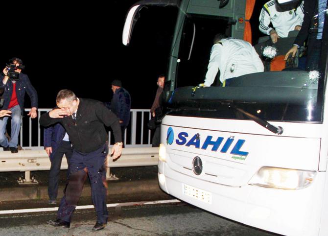 The wounded driver of Fenerbahce’s team bus holds his head after sustaining an injury when a gunman attacked the vehicle in Trabzon late on Saturday night. PICS/AFP