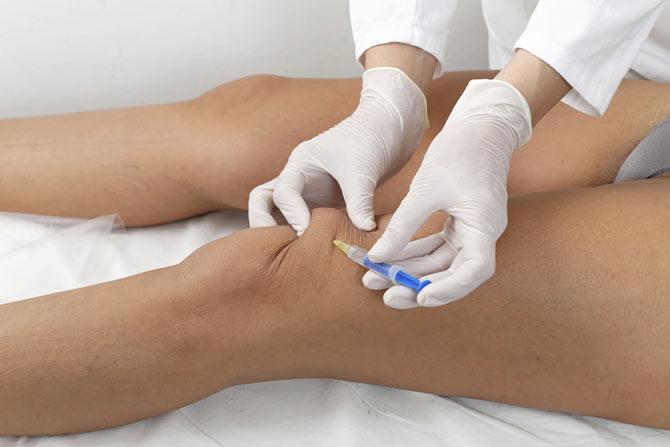 Injectable gel to treat knee injuries