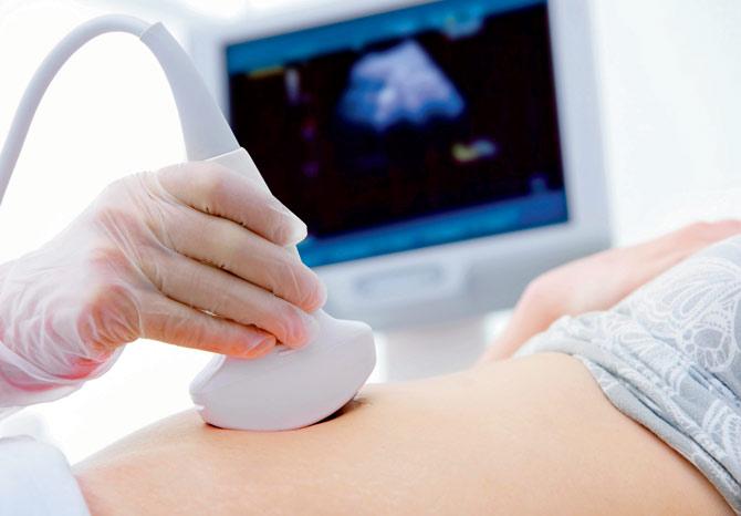 ALL OKAY: An ultrasound is one of the ways to detect PCOS