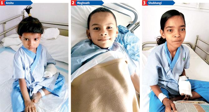 Blue no more: Anshu (3), Meghnath (6) and Shubhangi (12) are amongst the 11 kids who no longer have to suffer a life of illness, thanks to the donor who funded the surgeries fixing their congenital heart defects.