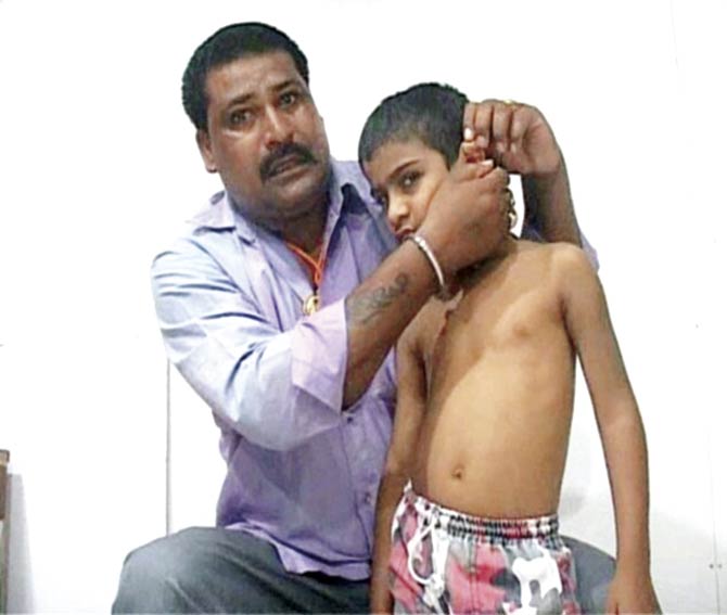 Kabir’s father points out an injury on the boy’s ear, received during one of the thrashings