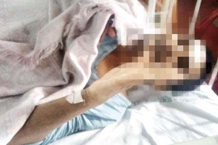 Patient stabbed at Thane Mental Hospital over tobacco