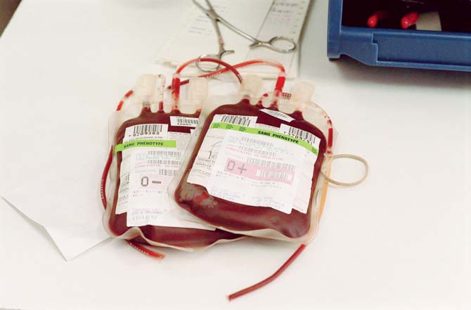 FDA is the licensing authority for blood banks. The Joint Commissioner (drugs) said they have investigated the matter and they will soon take action. Pic/AFP