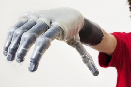 Mind-controlled bionic limbs replace limp hands