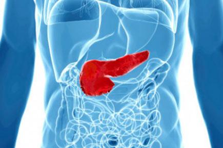 Pancreatic cancer discovery to improve treatment