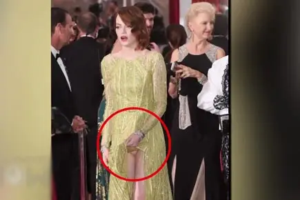 Emma Stone's wardrobe malfunction at the Oscars 2015