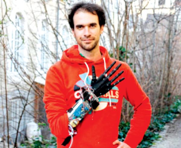 Nicolas Huchet with his robotic hand