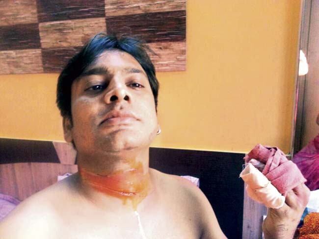 Shailesh Jain sustained cuts on his neck and hand due to the manja