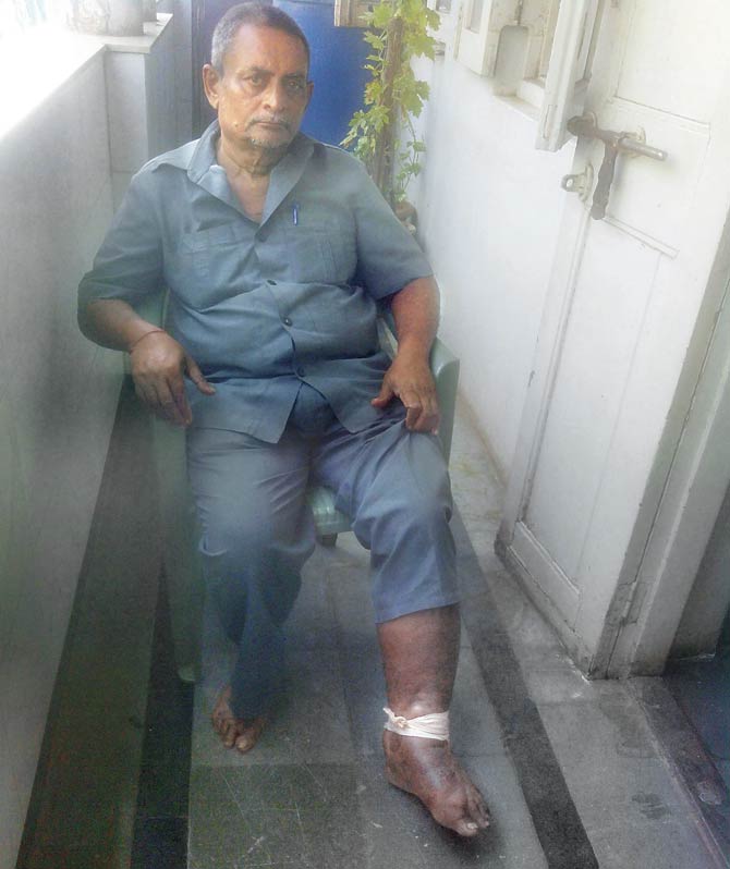 Anil Mehta was hit by a handcart twice on the same day and had to be hospitalised for two months after that
