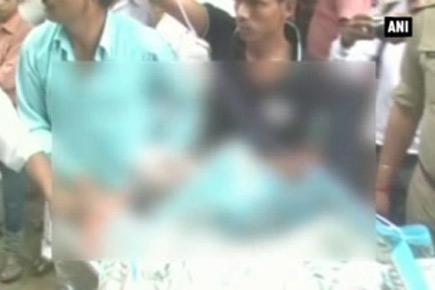 Woman allegedly set on fire by police officers in Barabanki