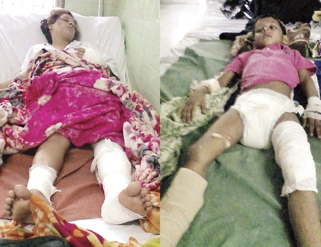 Farida and Zebran, two of the injured
