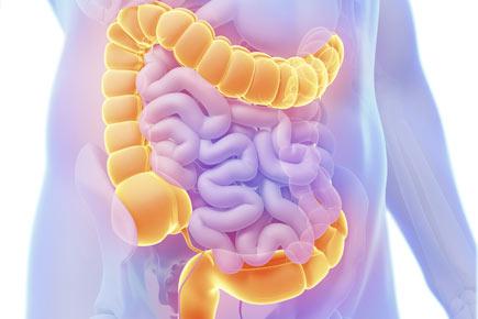 Younger immigrants at greater risk of developing bowel disease