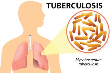 Health: A look at Tuberculosis, the global epidemic