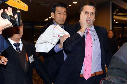 US envoy to South Korea attacked in Seoul