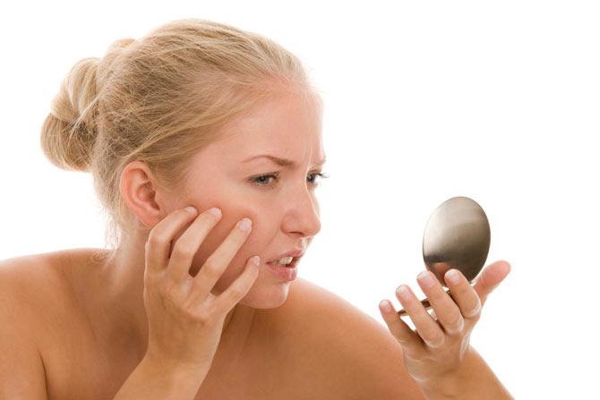 Five acne-causing habits you should stop