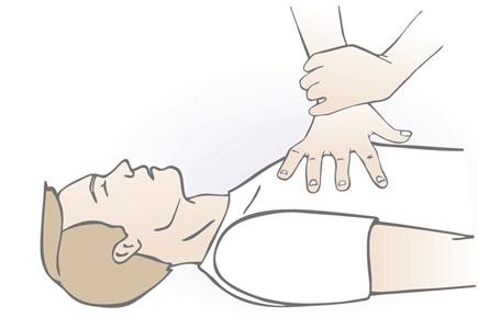 CPR by medics: Continuous pumping not a good idea