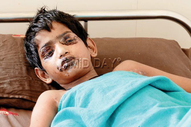 It was 11-year-old Prakash whose eyes and lips were severely scalded by the fumes as he opened the tap.