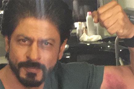 Shah Rukh Khan flaunts his 'love bite'