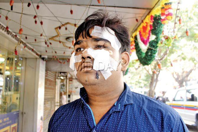 18-year-old Manish Chauhan was attacked as he came to the rescue of his two sisters. He was slashed on in his face and stabbed in the abdomen. Pic/Rajesh Gupta