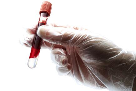Single blood test to predict premature death risk