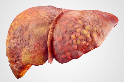 Gene potentially linked to liver damage identified