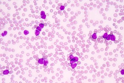 10 lymphoma facts on World Lymphoma Awareness Day