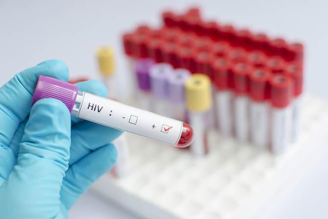 Researchers identify potent antibodies against HIV