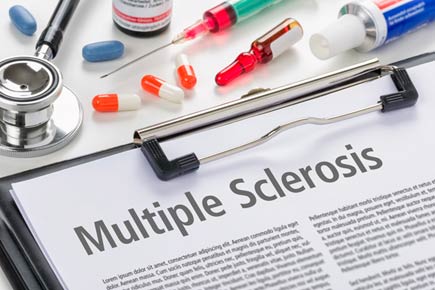 Multiple Sclerosis: Living in sunny climate may cut risk of the disease