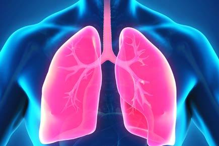 3D-imaging technique to precisely spot deadly lung disease