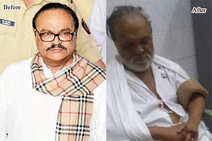 Chhagan Bhujbal almost unrecognisable, picture goes viral